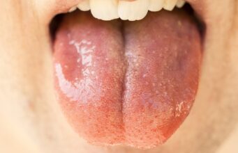 La importancia de la saliva